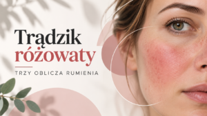 Read more about the article Skóra ciągle zaczerwieniona – czy z utrwalonym rumieniem można coś zrobić?
