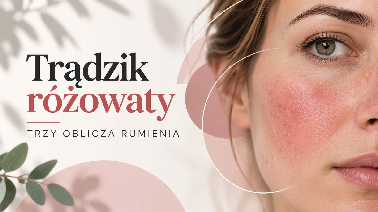 You are currently viewing Skóra ciągle zaczerwieniona – czy z utrwalonym rumieniem można coś zrobić?